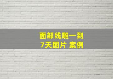 面部线雕一到7天图片 案例